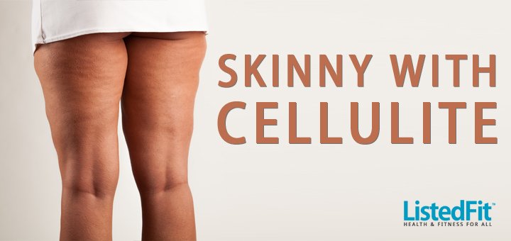 I’m Skinny With Cellulite – Is this Normal?