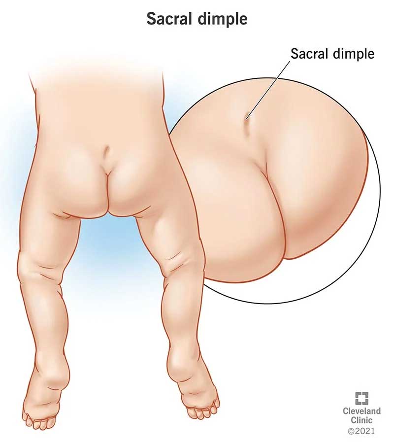 sacral-dimple-lower-back-dimples