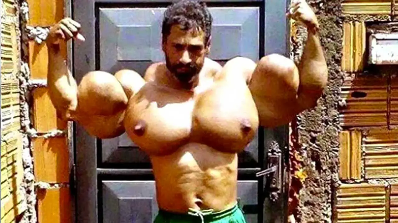 Why Would Anyone Use Synthol? Taking a Closer Look at Synthol Use