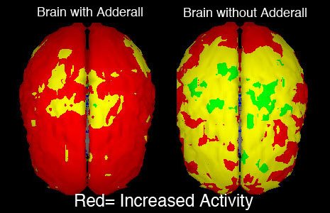 Cognitive Enhancing Drugs: The Best Way to Boost Your Brain? adderall
