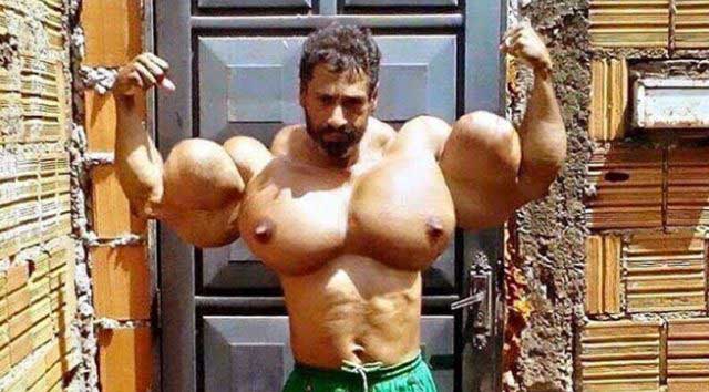 synthol-abuse pecs-guy-640x354